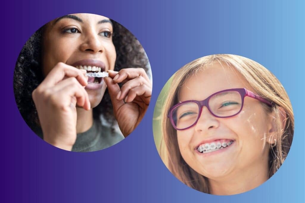 Two patients demonstrating smile results: one with clear aligners and another with traditional braces.