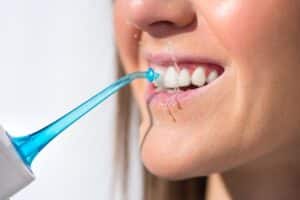 Patient using a blue water flosser to clean teeth and gums after dental bonding.