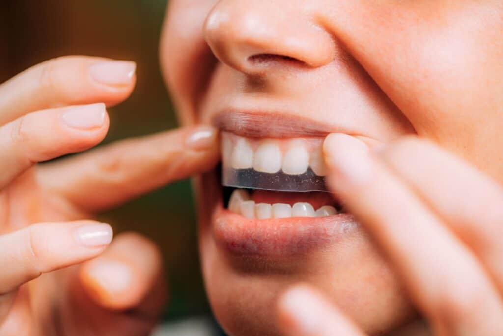 Person applying a teeth whitening strip to upper teeth.
