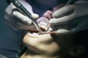 Dentist performing professional teeth cleaning with ultrasonic scaler on patient.