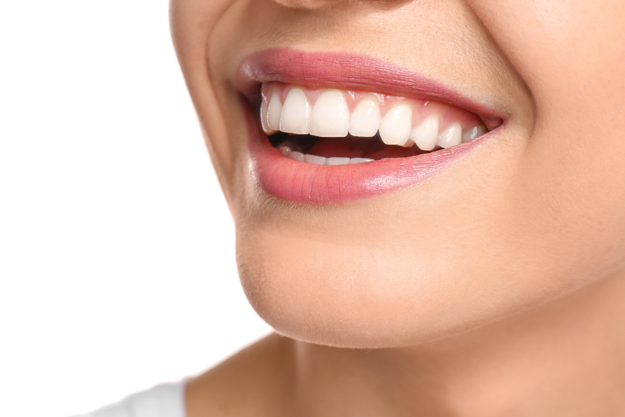 Close-up of a woman's healthy smile showing bright white teeth and proper facial proportions.